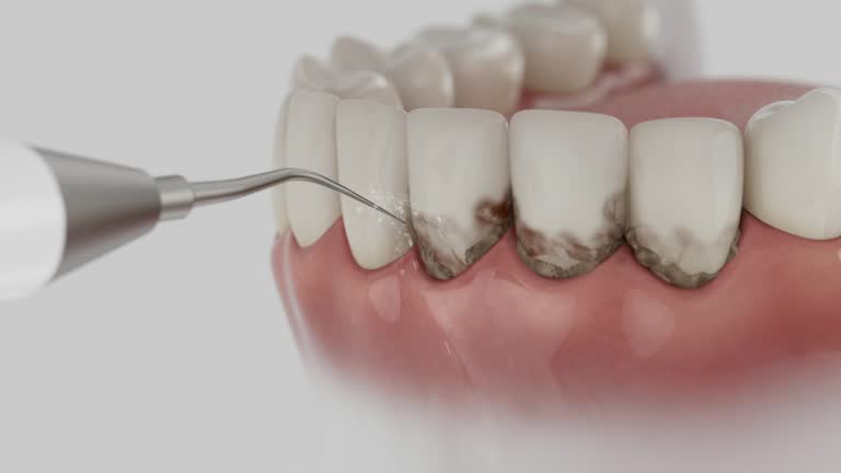 Reliable Dental Implants contractor in Springfield, MN by Smile Center Dentistry